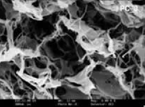 角膜クロスリンキング前の角膜内コラーゲンの様子